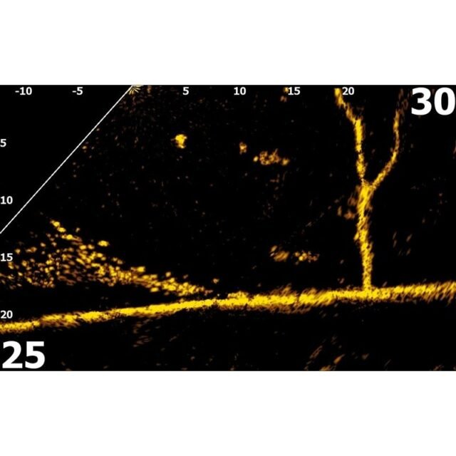 ActiveTarget 2™ Live Sonaras pilnas komplektas - Image 3