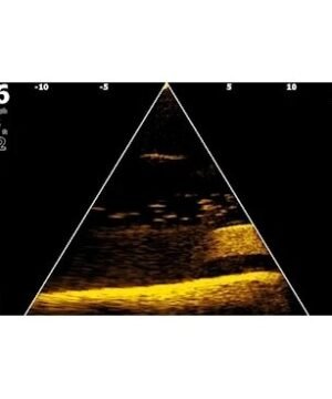 Alternative view of Naujas Echolotas Eagle Eye™ 9” & Worldwide Base Map Live Lowrance Transducer su integruota Ypatingai sufokusuotas gyvas sonaras sujungiamas su CHIRP ir DownScan Imaging™ su FishReveal™ viename